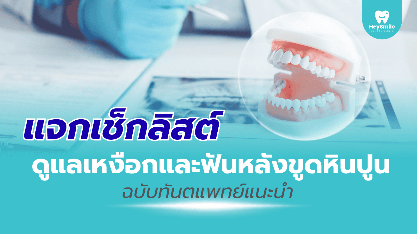 ขูดหินปูน