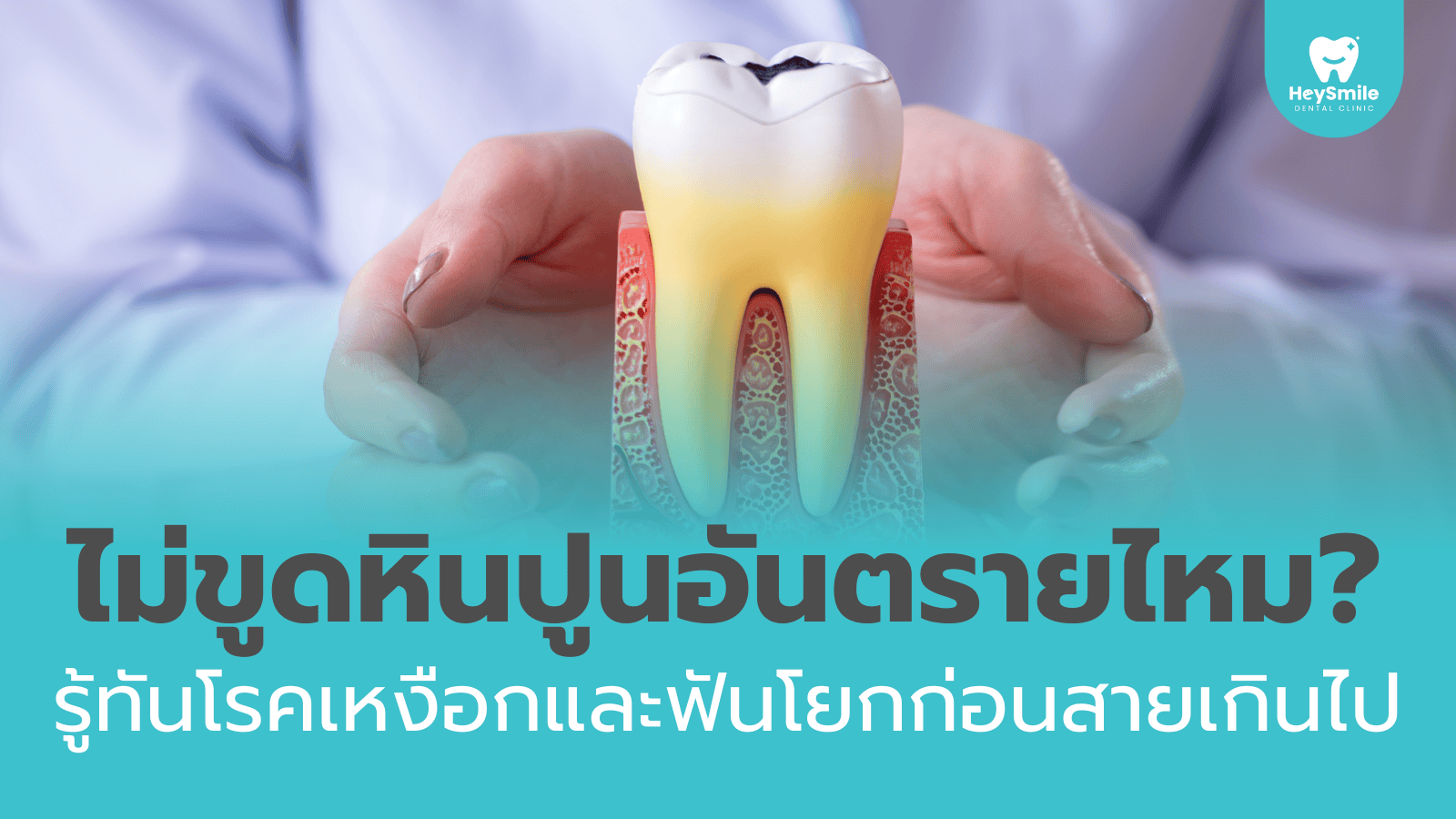 ขูดหินปูน