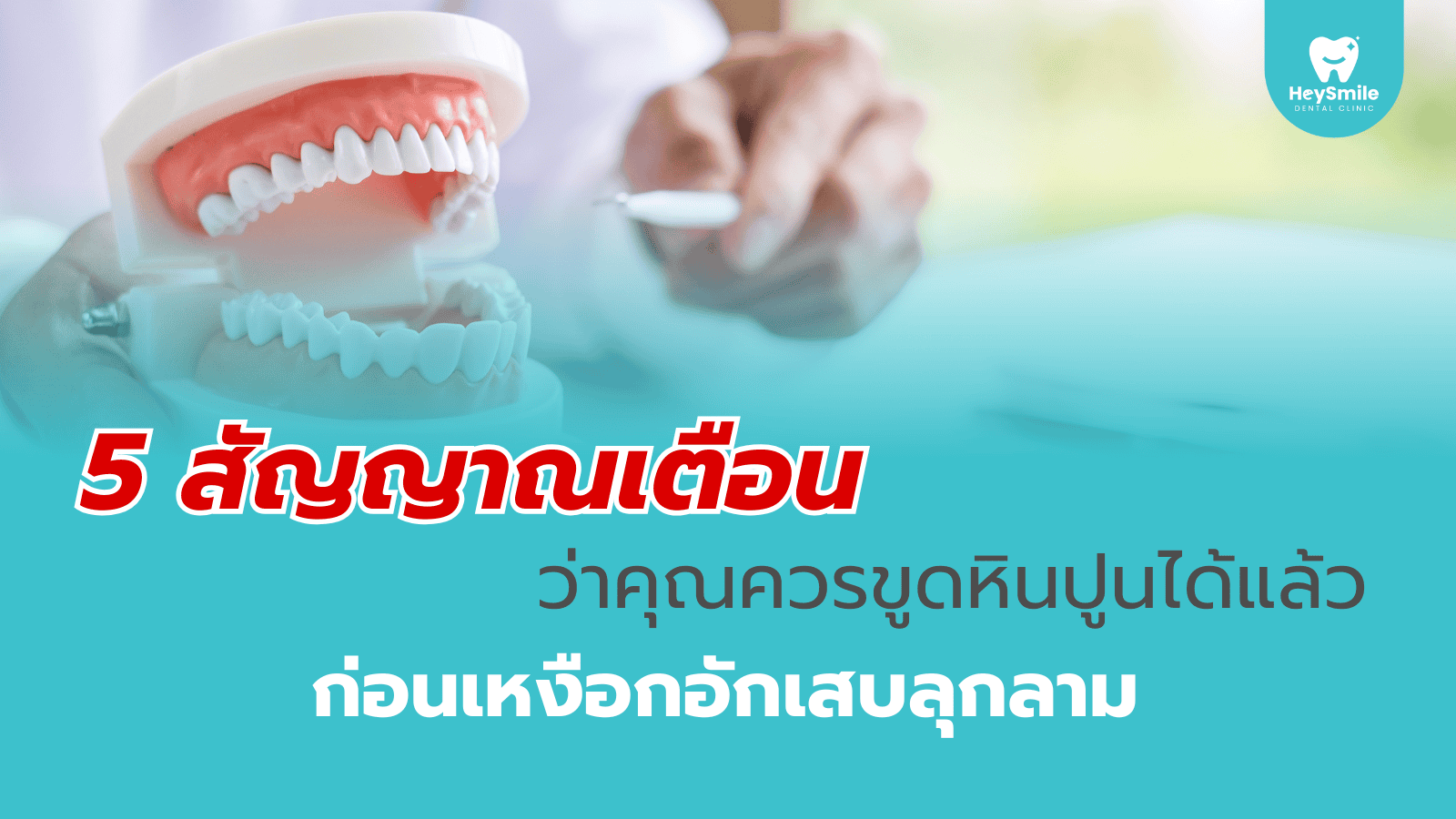 ขูดหินปูน