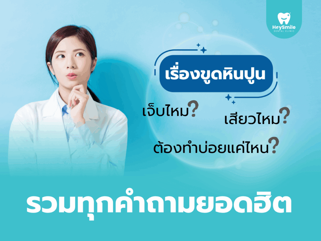 ขูดหินปูน