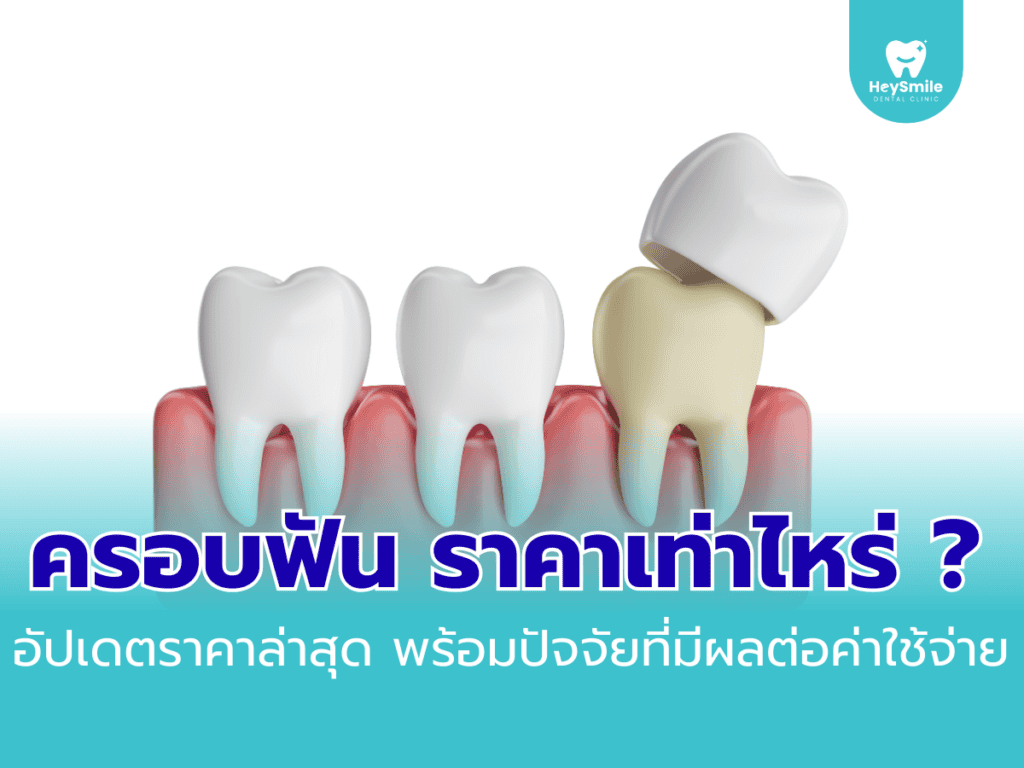 ครอบฟัน