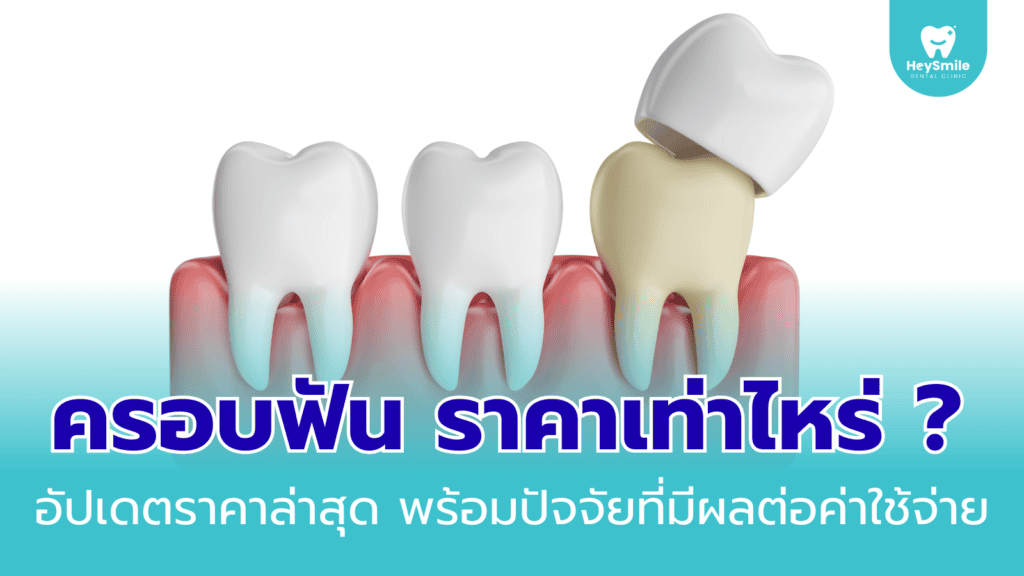 ครอบฟัน