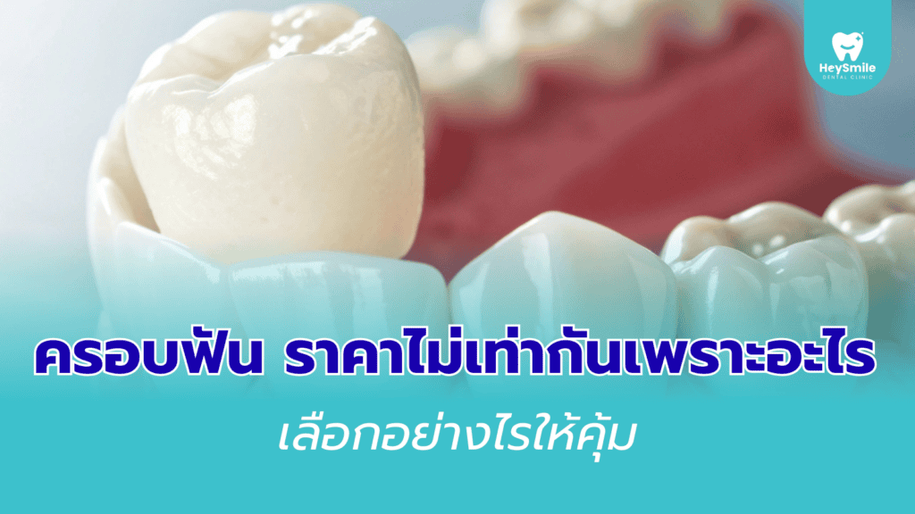 ครอบฟัน