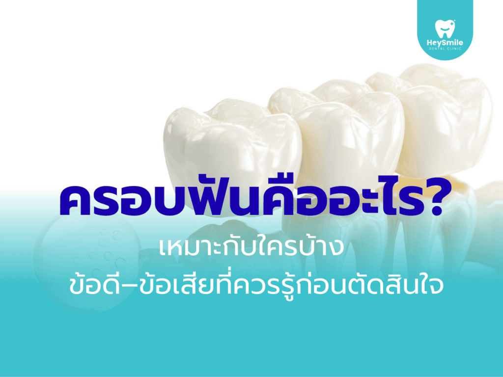 ครอบฟัน