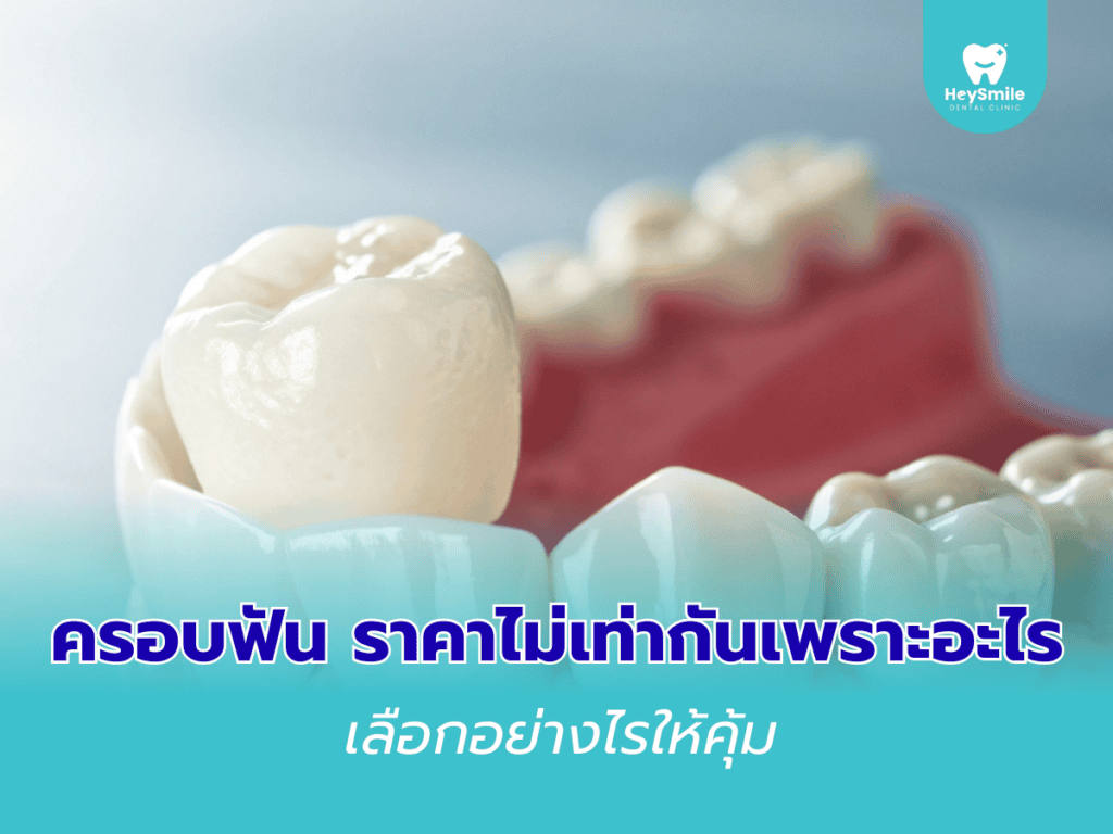 ครอบฟัน