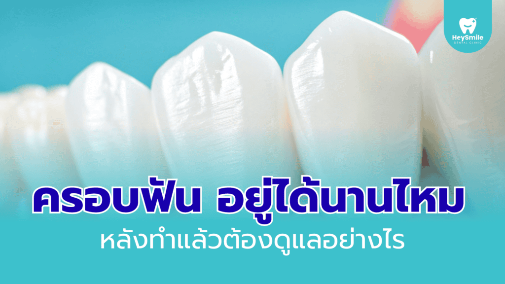 ครอบฟัน