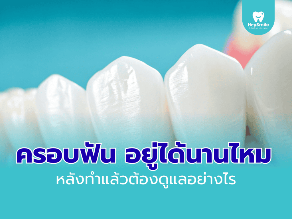 ครอบฟัน