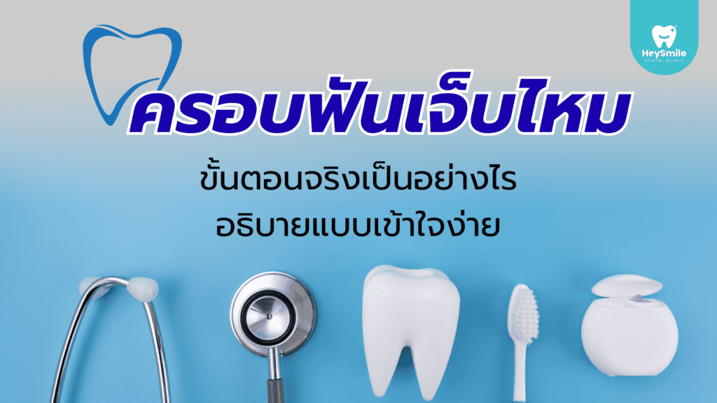 ครอบฟัน