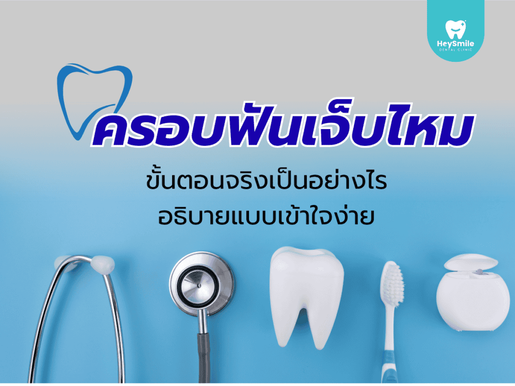 ครอบฟัน