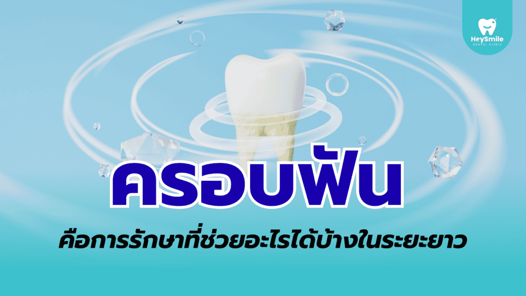 ครอบฟัน
