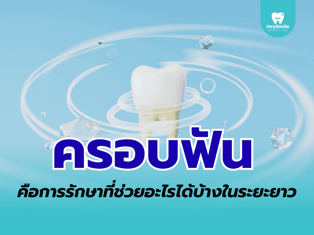 ครอบฟัน