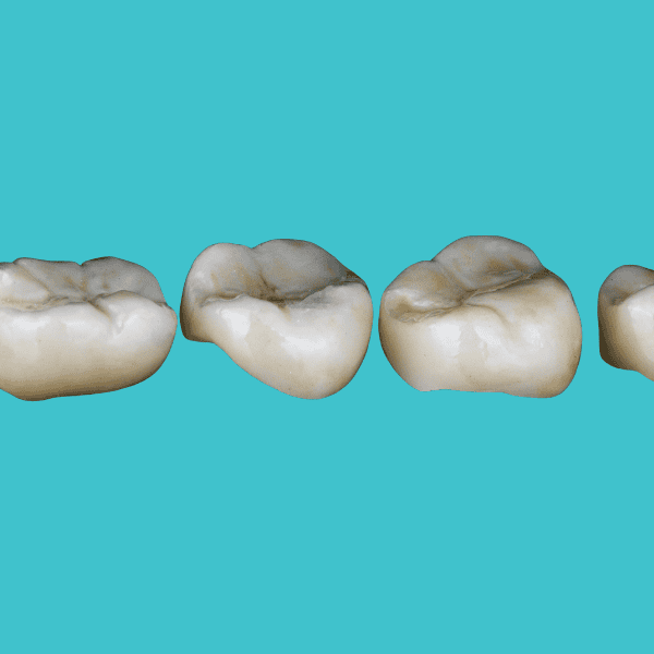 ครอบฟัน