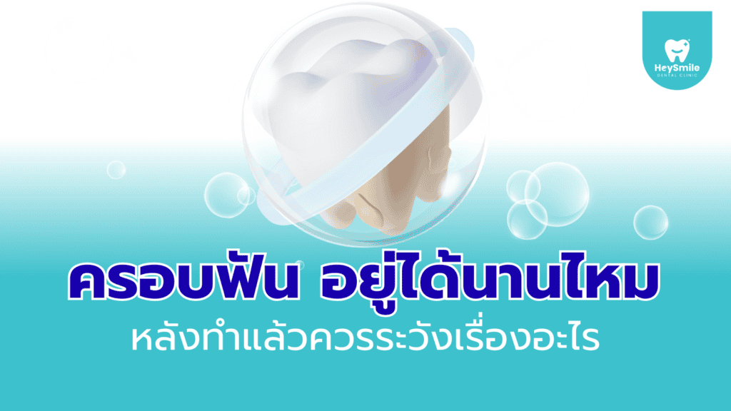 ครอบฟัน