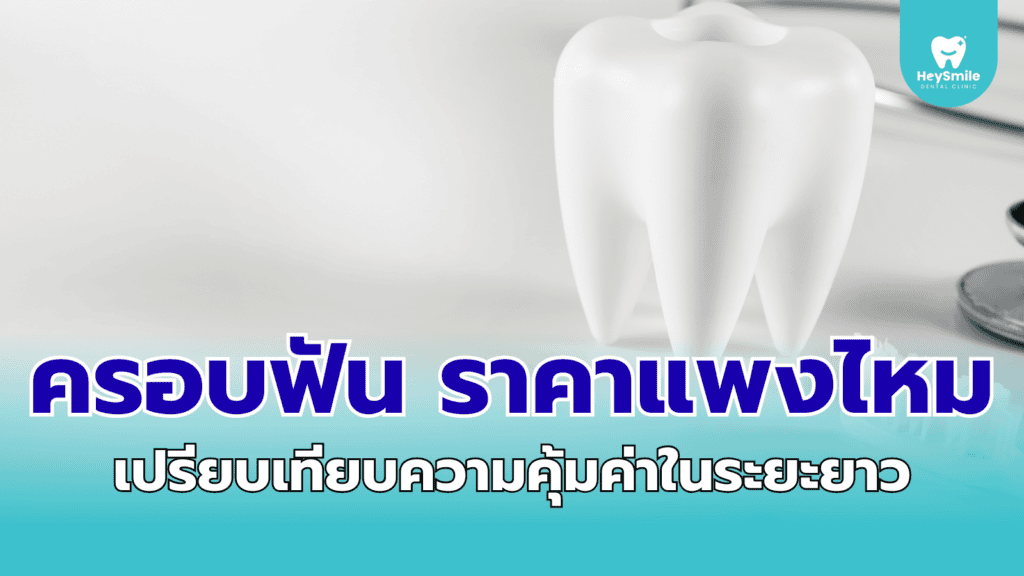 ครอบฟัน