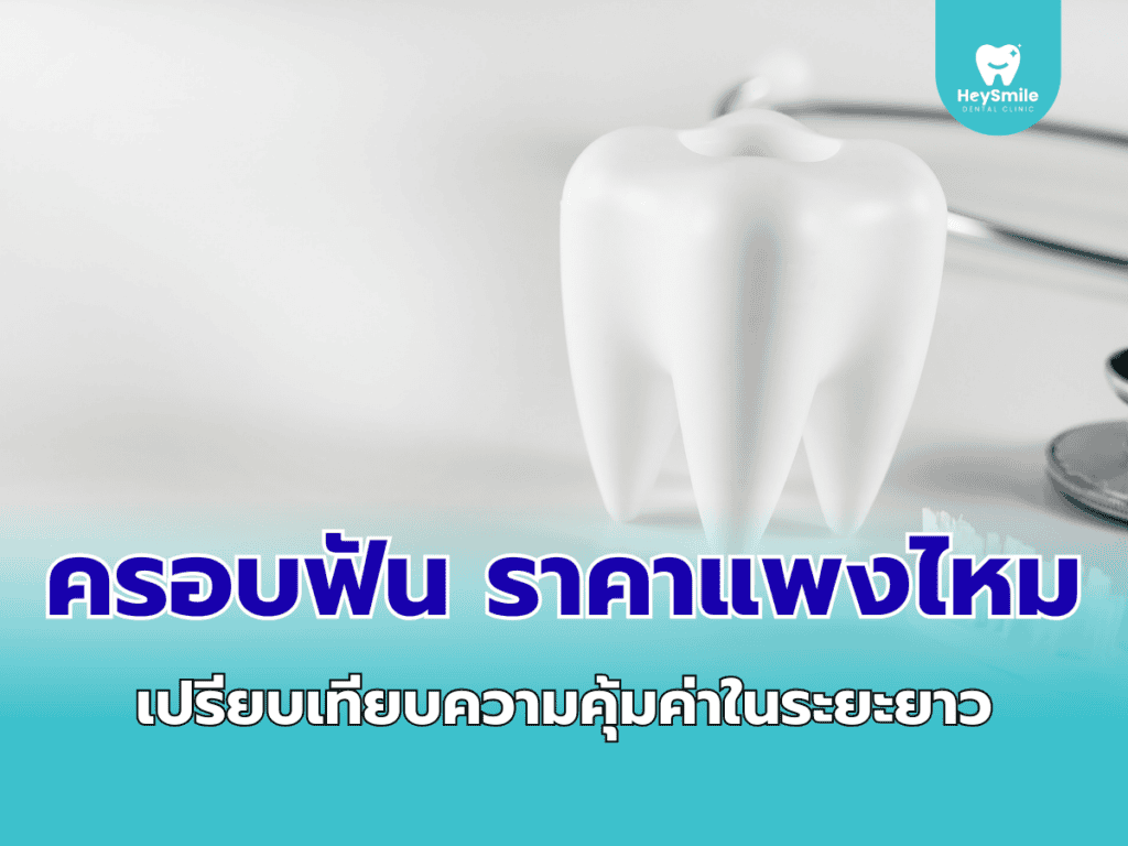 ครอบฟัน