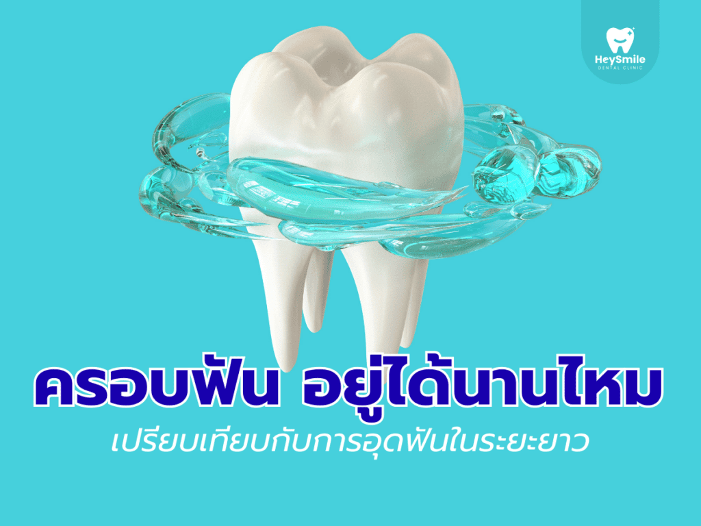 ครอบฟัน