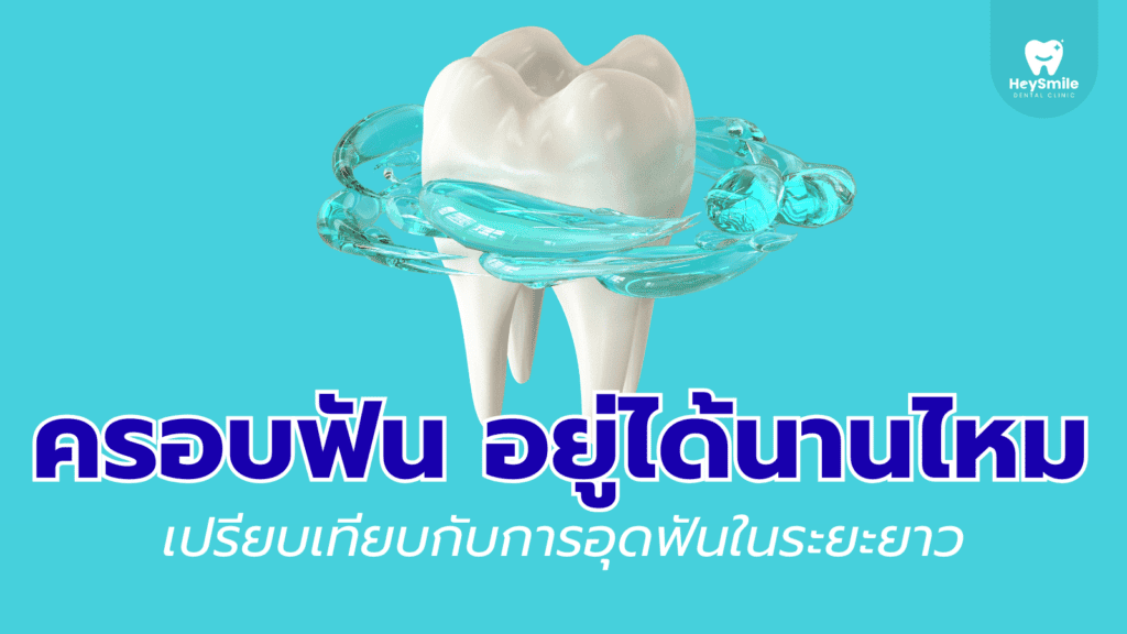 ครอบฟัน