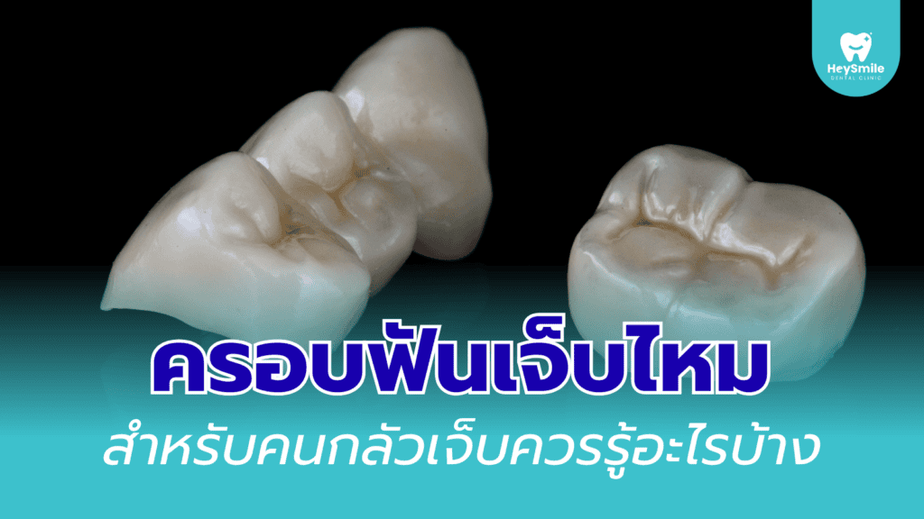 ครอบฟัน