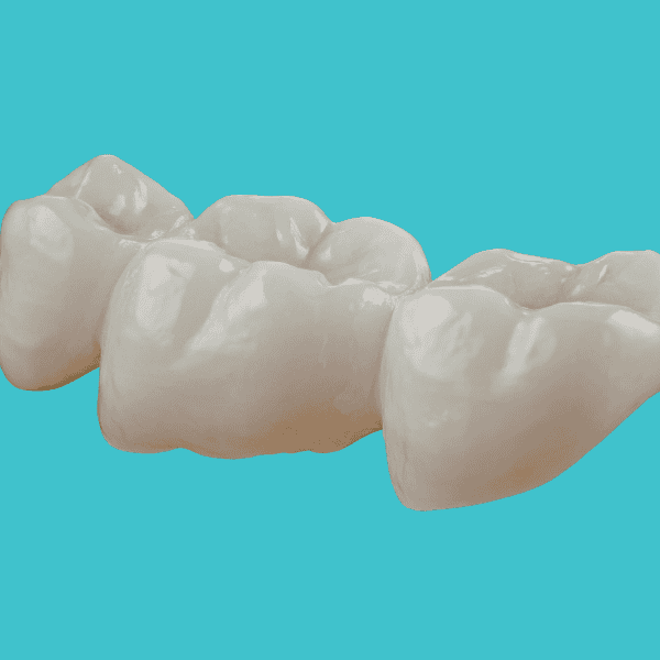 ครอบฟัน