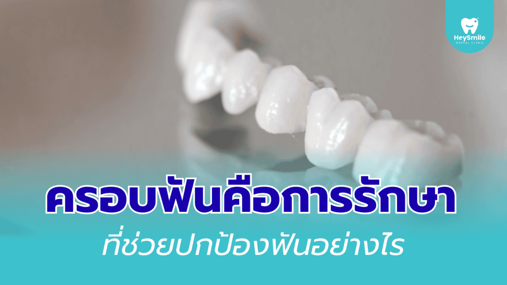 ครอบฟัน