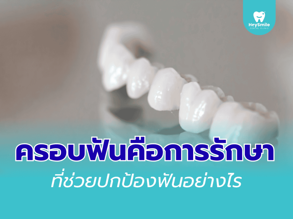 ครอบฟัน