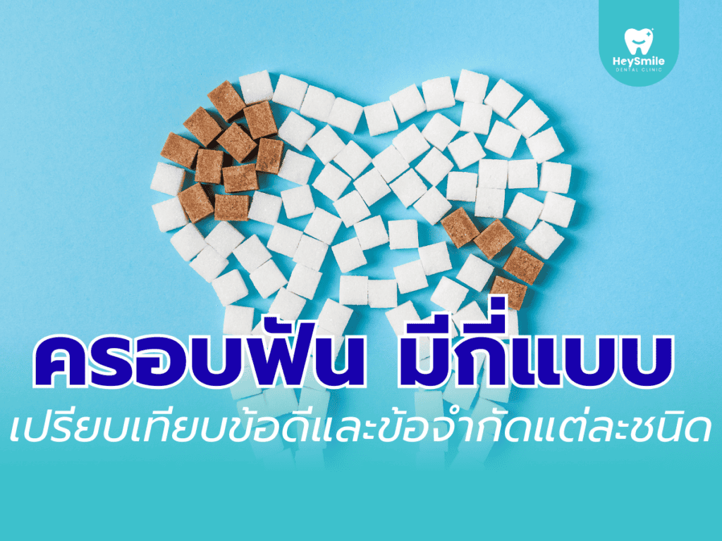 ครอบฟัน