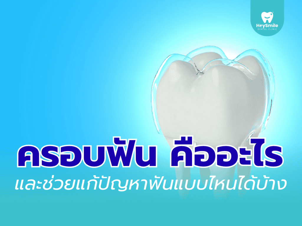 ครอบฟัน