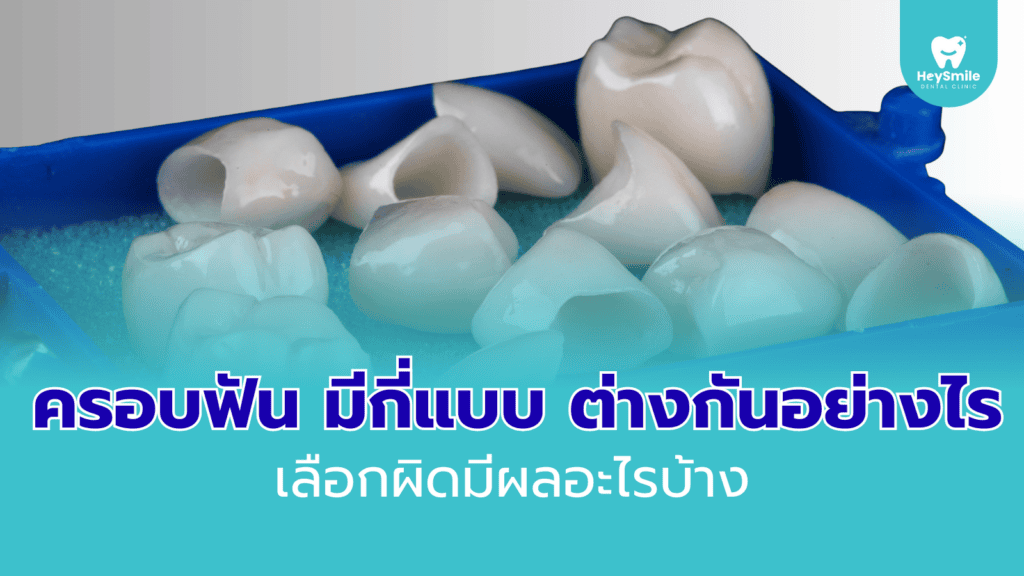 ครอบฟัน