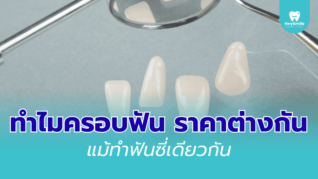 ครอบฟัน