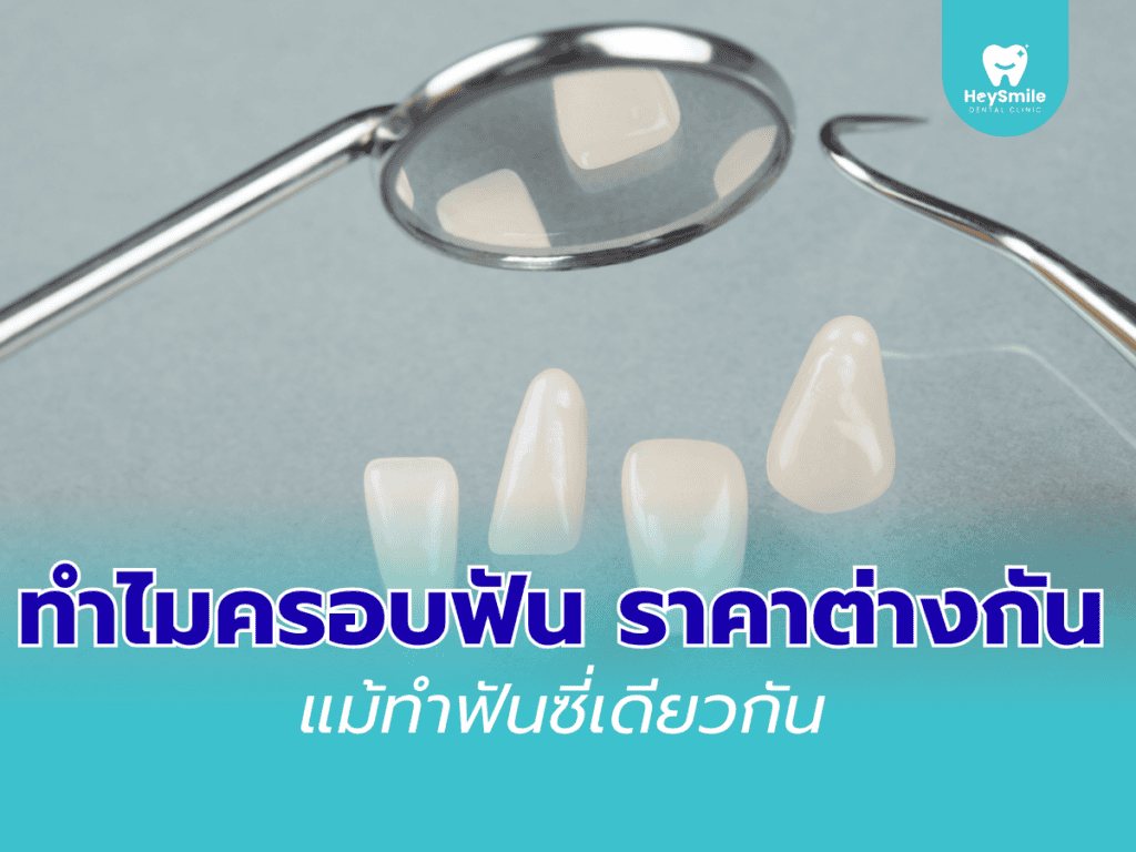 ครอบฟัน