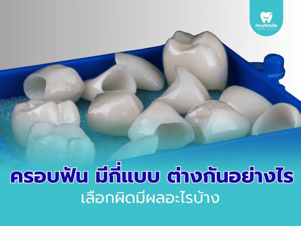 ครอบฟัน