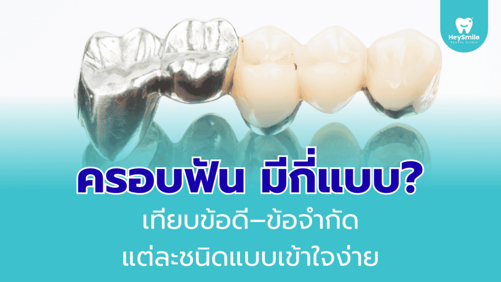 ครอบฟัน