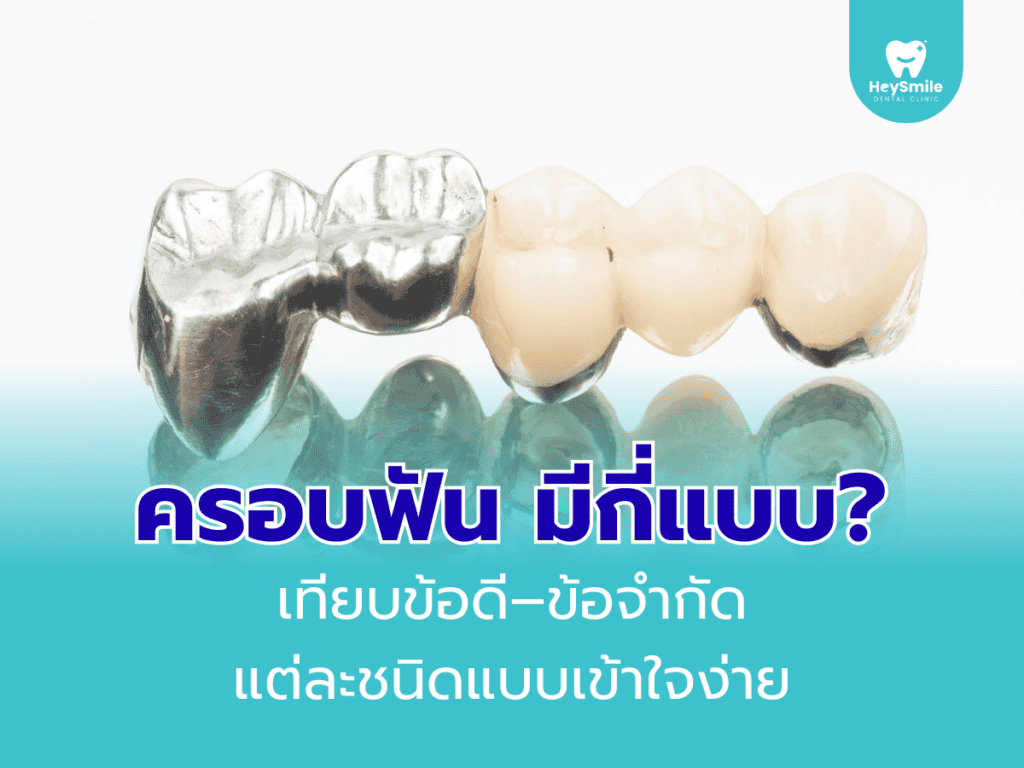 ครอบฟัน