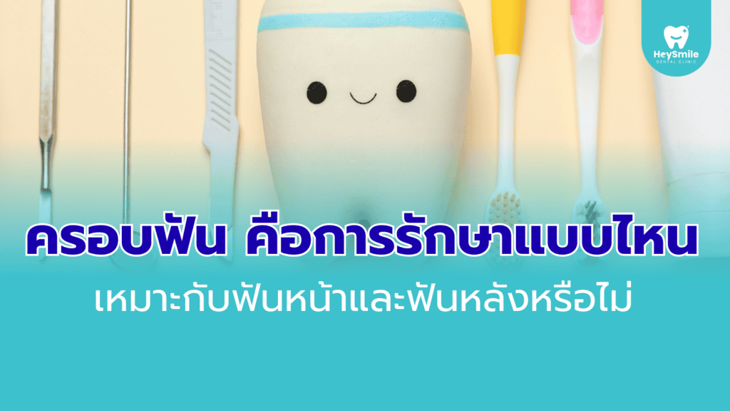 ครอบฟัน