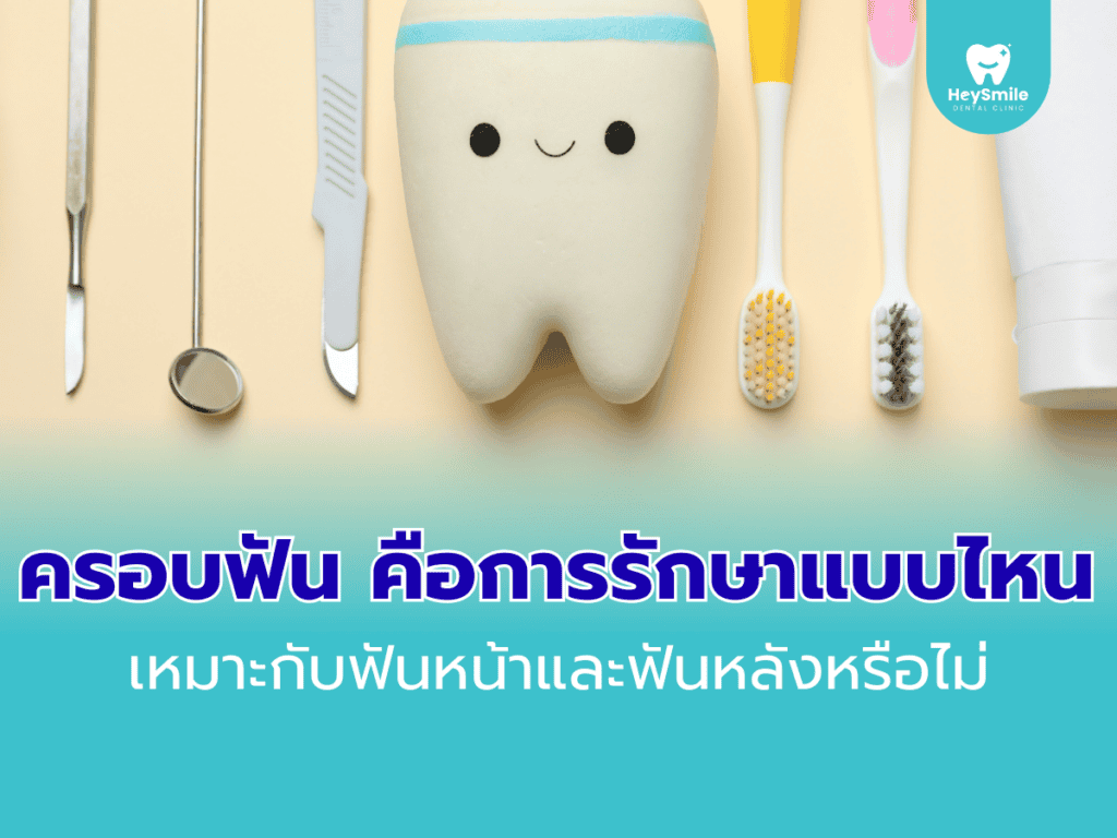 ครอบฟัน