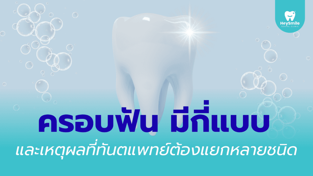 ครอบฟัน