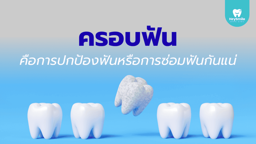 ครอบฟัน