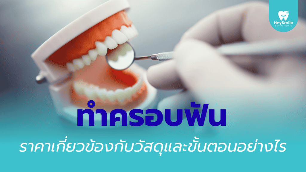 ครอบฟัน