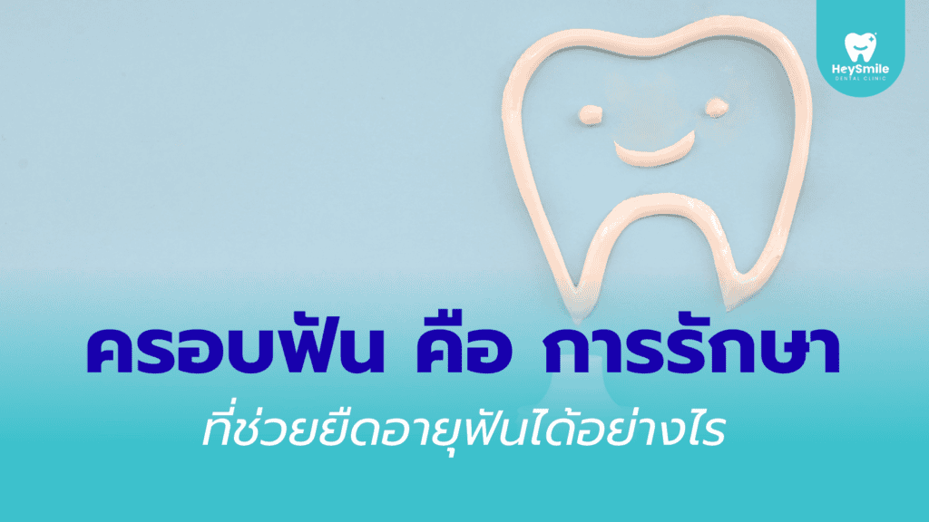 ครอบฟัน