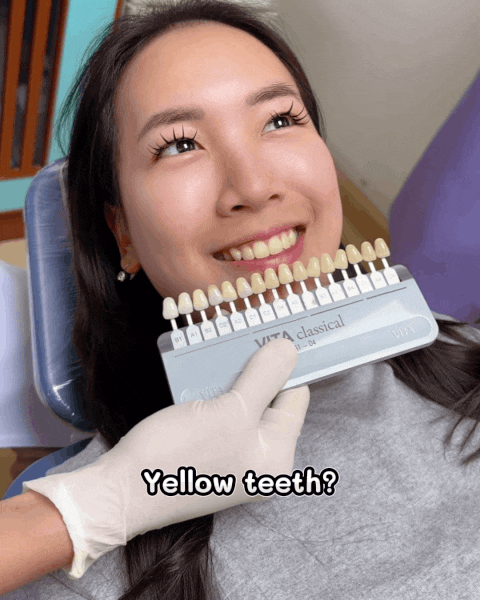 Teeth Whitening Bangkok